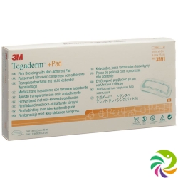 3M Tegaderm + Pad 9x25cm / Wundkissen 4.5x20cm 25 Stück